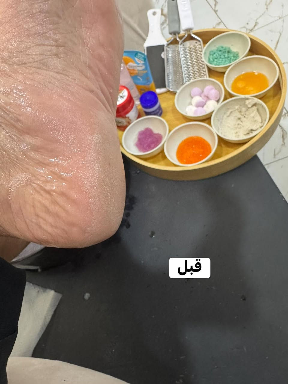 الدلال يمنه وبس  عرض لمدة ٥ ايام ب ١٢ الف فقط الاولوليه للحجز رقم الحجز ***********
