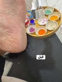 الدلال يمنه وبس  عرض لمدة ٥ ايام ب ١٢ الف فقط الاولوليه للحجز رقم الحج...