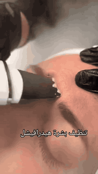 جلسه تنضيف بشره هيدروفيشيال 🤍🔥
فوائد تنضيف البشره :

✅-إعادة النضارة للبشرة الباهتة وتحسين ملمس البشرة.
✅-تقليل إفراز الزيوت في البشرة الدهنية 
✅-تخليص البشرة من الرؤوس السوداء والبيضاء.
✅-تحفيز الكولاجين الذي يعطي نتائج فورية.

العنوان الخاجيه شارع 40 داخل السوق لعصري 🌲 حبايبي اسم مالتنه نونه اكرلك ماعدنه غير فرع
***********
