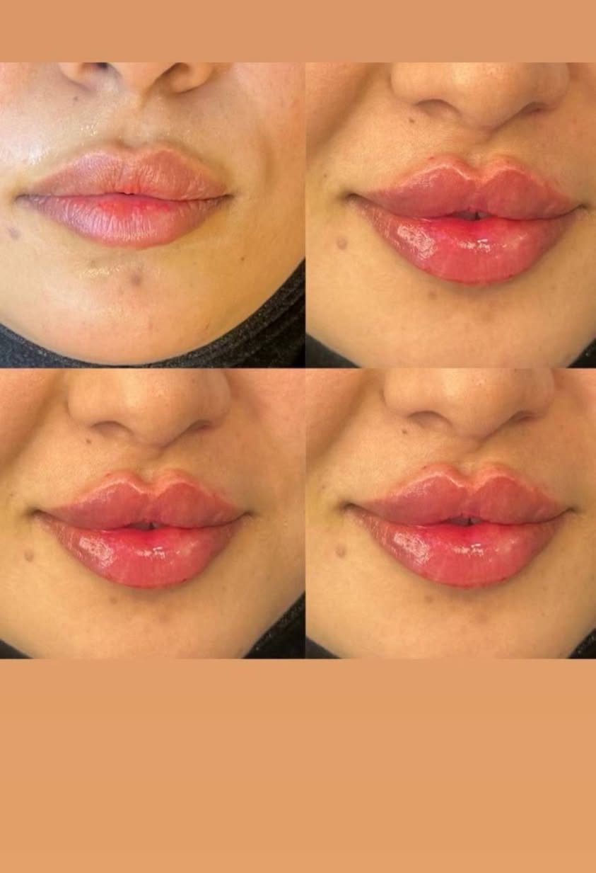 هلاو  بنات  عرض  العيد
فلر  شفه  الكوري ٣٠
 فلر  شفه  السويسري  ٤٠ 
فلر  شفه  الانكليزي  ٤٥ 
فلر  شفه  الايطالي  ٥٠
............. فلر الوجنات ........... 
فلر االخدود  الكوري  ٢٠  سي  الواحد 
فلر  الخدود  السويسري ٣٠ سي الواحد 
فلر  الخدود  الانكليزي  ٣٥  س الواحد 
فلر  خدود اليطالي ٤٠  س  واحد 
كل  اثنين  اخوات  او  صديقات  تاخذون  سيسي  مجاني  
..................... ابرةالنظاره ...... 
عرض  ابرة  الرتفال  ٢٥  
ابرة  العنبر  + ابلازمه  ٣٠ 
ابرة  طماطه  +  تنضيف  بشره  عميق  ٢٥ 
 ابرة  العروس  +  الفيتامين  سي  ٢٥ 
 ........................مكس  الايطالي  الخاص بدكتورا  ٥٠ الف  
تنضيف بشره  عميق هديه  
كل  اثنين  صديقات  او اخوات  الهم  هديه بختيارهم  من  داخل  صالون  
 ........ تغير شامل  الفلر  كوري  ١٠
يشمل  الخدود 
تكساس  
ذقن  
اصداع  
شفه  
150الف  
............. تغير شامل  الفلر  الاسويسري  ....... 
الخدود  
تكساس  
ابرزاز  ذقن  
اصداع  
شفه 
........... 200الف  +  اابرة الفيتامين سي هديه 
 ....... تغير شامل  الفلر  الايطالي  ....... 
الخدود 
تكساس  
ابراز  ذقن  
اصداع  
شفه 
250الف   +  ابرة العنبر  +بوتوكس  سحب  الحاجب


**إذا كنت صاحب هذا الإعلان وتريد حذفه لأي سبب، رجاءا أرسل رسالة إلى الدعم الفني**