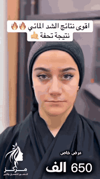 ✨ عرض خاص – الشد المائي للوجه بسعر 650 ألف فقط 💧 شد فوري ونضارة طبيعية...