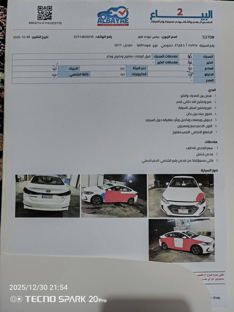سلام عليكم النترة موديل 2017 خليجي رقم ذي نص فول سيارة خير من الله تبريد قطعتين  سونار جديد يحكم السعر 120وبيه مجال  العنوان بغداد الكرخ حي التراث الاستفسار ***********.    ***********.    سنويه جديدة هزاز صدر جديد تخم تاير ويل كب سيارة مال جناي خير من الله مشروع وطني وين ماتريد احولك بسمي السيارة
