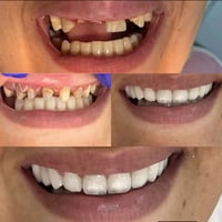 المختبر الفني السوري  لصناعة الاسنان و التعويضات السنية وتركيب الأسنان...