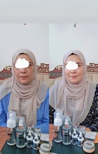 مجموعة اللومي • تفتيح وتوحيد اللون • تضييق المسام