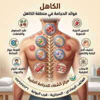 مركز الشفاء • حجامة طبية • الرمادي السجاريه