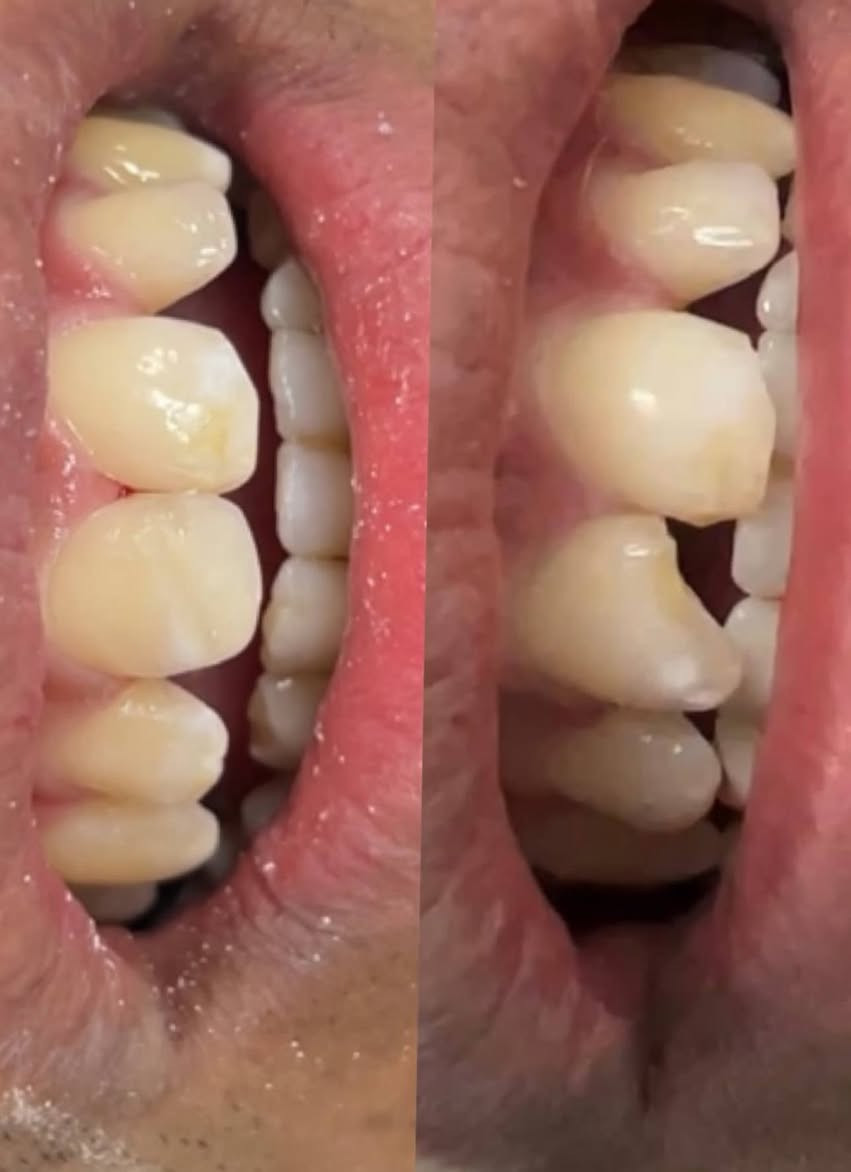 علاج اسنان مجاني في عيادات جامعة المنارة
للحجز الاتصال على الرقم 
 ‏‪0770 702 4073‬‏
