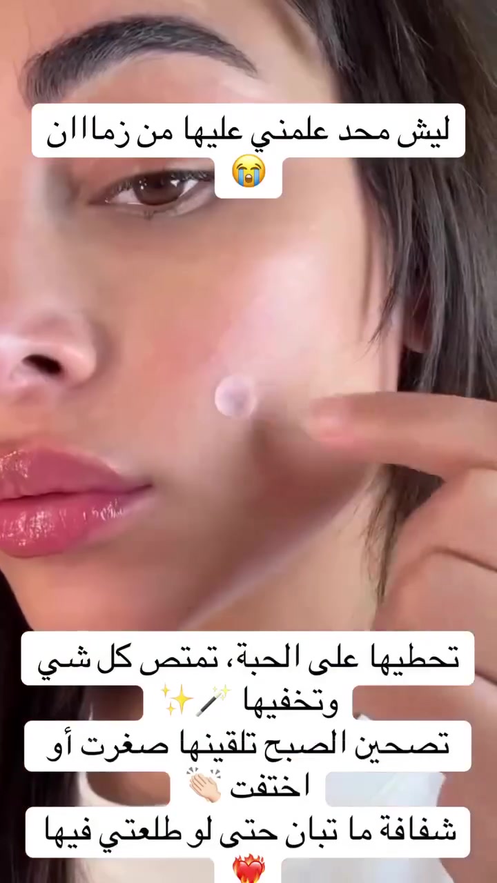 ✨ لاصقات حمض الساليسيليك لعلاج الحبوب ✨
الحل السريع لكل حبة مزعجة 😍🔥

✔️ تحتوي على 36 لاصقة
✔️ تساعد على تجفيف الحبوب بسرعة
✔️ تقلل الاحمرار والالتهاب
✔️ تمتص الدهون والشوائب من البشرة
✔️ مناسبة لكل أنواع البشرة

💖 استخدميها بكل سهولة وخلي بشرتچ صافية ونقية بدون آثار

السعر ٨
 #بنات #شباب #بغداد #محافظات #توصيل


**إذا كنت صاحب هذا الإعلان وتريد حذفه لأي سبب، رجاءا أرسل رسالة إلى الدعم الفني**