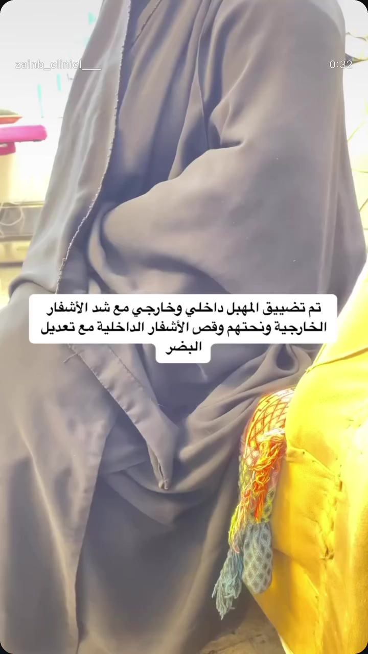 تضييق المهبل وقص الاشفار وابرتين هدية تبييض وتوريد بغداد الشعلة شارع هباوي *********** العيادة تضم طبيبة جراحة وقابلة مادونة
