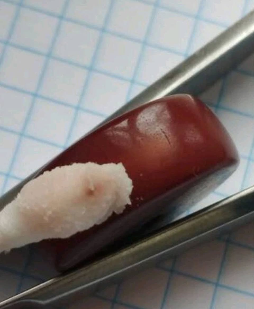 خرز قرصي مسطح أحمر عتيق، ربما من الباكليت، بلاستيك مضغوط قديم، 290 دولارًا أمريكيًا.
خرز قرصي مسطح عتيق لصنع المجوهرات. هذا الخرز مصنوع من بلاستيك مضغوط قديم، ربما من عصر الباكليت. يتميز الخرز بشكله القرصي المسطح (الدونات) ولونه الأحمر الداكن المائل إلى العنابي مع لمسة نهائية ناعمة كالحرير.

ملاحظة حول المادة: المادة الدقيقة غير معروفة ولا يمكن ضمانها. تم إجراء اختبار تفاعل قياسي (كما هو موضح في الصور)، ويستند الوصف إلى نتائج الاختبار. يُرجى إجراء تقييمك الخاص قبل الشراء.

ملاحظة: قد يختلف اللون قليلاً من خرزة إلى أخرى - بعض الخرز أغمق من غيرها. قد توجد بقع صغيرة أو علامات سطحية أو عيوب طفيفة بسبب القدم.


**إذا كنت صاحب هذا الإعلان وتريد حذفه لأي سبب، رجاءا أرسل رسالة إلى الدعم الفني**