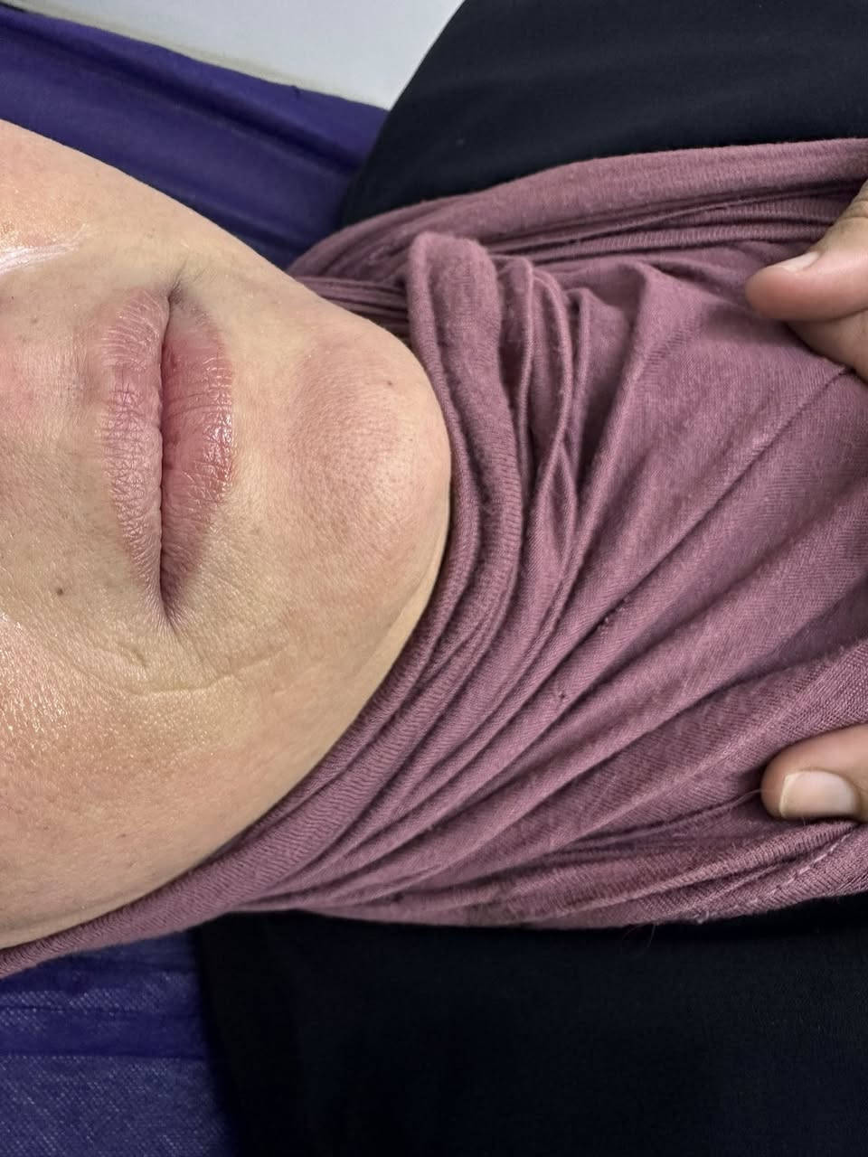 عيادة الدكتورة شذى عبد الامير للجلدية والتجميل شارع العمارة الحمرة مجاور معهد الشمس
ماكيره فاطمهام اسد@
