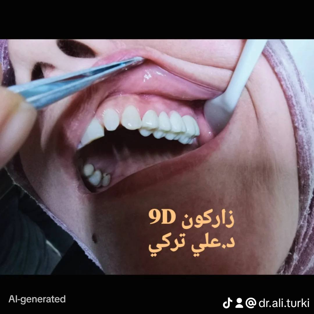 السلام عليكم 🌺
تركيب أسنان زاركون 💥
في عيادتنا 🏅
د.علي تركي عبادي  💯
للحجز والاتصال ☎️

0774 988 9272
