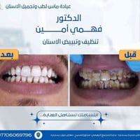 عيادة ماس • تجميل اسنان • بسمايه