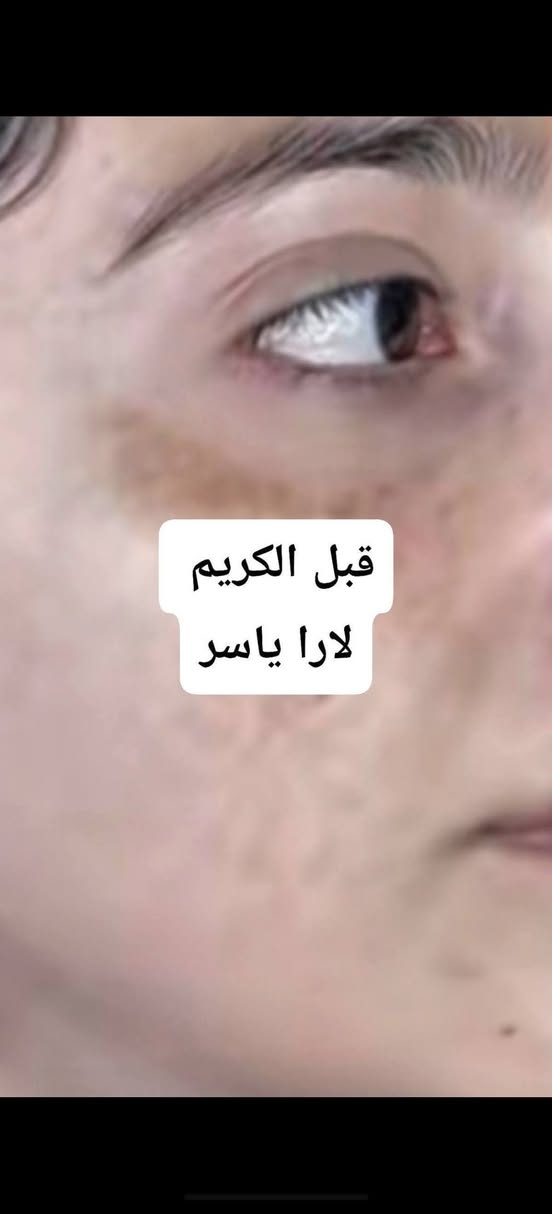 الحمد الله على نتائج كريم لارا ياسر
فديت كيكاتي احبكم 😘😘😘


**إذا كنت صاحب هذا الإعلان وتريد حذفه لأي سبب، رجاءا أرسل رسالة إلى الدعم الفني**