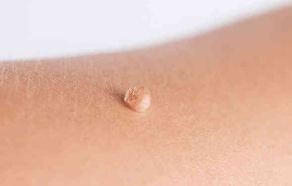 عيادة المتميزين التمريضيه (الرجال . والنساء )

🌸 إزالة الزوائد اللحمية الجلدية النسائية بكل أمان وراحة 🌸

هل تعانين  من الزوائد اللحمية و الجلديه 
🌸 إزالة الزوائد  اللحميه و الجلدية النسائية بكل أمان وراحة 🌸
الآن يمكنك التخلص منها بسهولة مع جلسة إزالة دقيقة وآمنة دون ألم يُذكر

✨ مميزات الخدمة:

إزالة سريعة خلال دقائق

بدون جراحة وبدون نزيف

أدوات معقمة ومعتمدة

خصوصية تامة للسيدات

نتائج فورية واستعادة الثقة من أول جلسة

✨ مناسبة لـ:
الزوائد الجلدية – الزوائد اللحمية – ( الرجال اي يوم )

📍 للسيدات فقط – حجوزات – سرية تامة
📞 للتواصل والحجز: (***********)
📆 م – موقع قريب من
 شارع الخليج بصف البنزين خانه الداخلية بصف همبركر خيري بصف همبركر حسوني بصف صيدلية ركن الخليج 

💗 لأن راحتك وجمالك أولويتنا 💗
