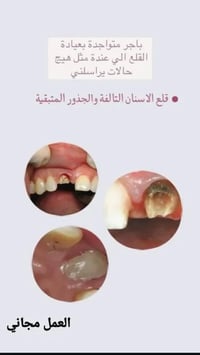 مجانا • عيادات • جامعة واسط