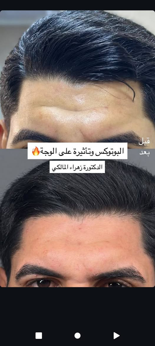 عنواننا النجف ركن السلام جامعه(الاربع شوارع) مجاور ازبري قرب يو كافيه
https://www.instagram.com/reel/DVoo2aKjQVT/?igsh=Mzd2cjQydXVzMXRiللحجز ***********
