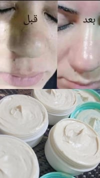 خلطة كلف • خلطة تبيض • ضمان سبوع