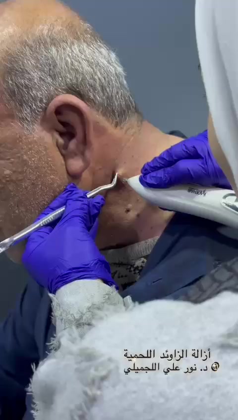 السلام عليكم 
رمضان كريم 
دوام العيادة راح يكون بعد الإفطار يومياً من ساعة ٧ ونص للساعة ١١ مجمع فينيسيا الطبي الشرقاط السايدين مقابيل اهل الاسمنت قريب سنتر الصلطان الحجز ولاستفسار عل ارقام التاليه  ***********
***********
