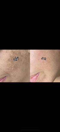 نتائج كريم • لارا ياسر • مستحضرات تجميل