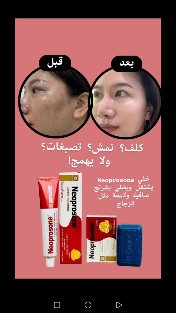 الكلف مزعجج؟ النمش مضايقج؟ خلي Neoprosone يرجّعلج صفاء بشرتج يقلل التصبغات، يفتح اللون، ويخلي الوجه صافي مثل الحليب يتكون من عصاره +صابونة 💯💯

♦️. كريم نيوبروسون المشهور عالميا 
Neoprosone Forte 
منتج امن و مجرب ومضمون وماركة عالمية
مكوناته اعشاب امنة على البشرة وعلاجية دائمية قبل متكون تجميلية 
علاج طبي بامتياز
🌟 اهم المميزات 🌟
✔احسن علاج لتفتيح وتبيض البشرة
✔معالجة للكلف والنمش 
✔معالجة للاكزمة والطفح الجلدي والحكة والتحسس 
✔معالجة للتصبغات الجلدية والبقع والاسمرار
✔معالجة اثار حب الشباب واسمرار الشمس 
✔خالي من الكورتزون 
✔خالي من الزئبق 
 💡افضل منتج للكلف ولإسمرار البشرة وتقشر الجلد الخارجي وتبيض البشرة وتفتيح لونها👍

♦️. صابونة نبريسون :: Neoprosone
مبيضة لبشره بصورة سحريه 
تخلصك من حب الشباب نهائياً 
علاج للنمش 
علاج للكلف 
علاج للهالات السوداء 
 اعشاب طبيعيه ونباتات طبية 💯
🚘يوجد خدمة توصيل لجميع محافظات العراق 🚘


**إذا كنت صاحب هذا الإعلان وتريد حذفه لأي سبب، رجاءا أرسل رسالة إلى الدعم الفني**