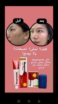 نيوبروسون • يفتح اللون • يعالج الكلف