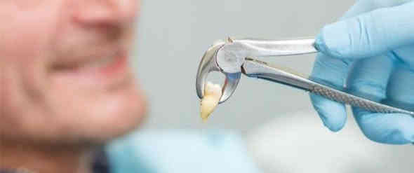 🔴 اعلان علاج مجاني... 

سلام عليكم.... وياكم دكتور محمد طب اسنان مرحله رابعه جامعه المناره... الي عنده اسنان تالفه او جذور متبقيه ويريد يقلعهم يتواصل وياي على الرقم *********** واتساب علما انو دكتورات بنات موجودات إذا اهلك او اهلج هم حابين يقلعون والأطفال أيضا هم مشمولين إذا ابنك صغير ويحتاج قلع... ويتم العلاج مجانا اكيد وبأحدث الأدوات المعقمه وتحت اشراف دكاتره اختصاص...المكان جامعه المناره مجاور مستشفى الصدر التعليمي وذالك في يوم السبت ( غدا) الساعه 12 ظهرا

طيب هسه تكول اني من اقلع شنو استفاد خوب ابقيهن بحلكي يا دكتور !!

هسه اجاوبك شوف اذا تبقي الإسنان التالفه او الجذور بدون ما تقلعهم ف اولا رح تسببلك رائحه كريهة بالفم ومهما حاولت انو تزيلهة بغسول الفم او العلج ما رح تروح وثانيا رح تسويلك التهابات باللثه بس ممكن انت هسه ما تحس بيهة بس رح تشوفهة مستقبلا وثالثا رح تسويلك ذوبان بالعظم الي حول السن ف بتالي مستقبلا إذا ردت تسوي طقم او جسر ما رح يرهم عليك ورابعا رح يأثر ع الإسنان المجاوره وممكن ابعض الحالات يسويلك صداع اي الم بالرأس.

للتواصل *********** واتساب
