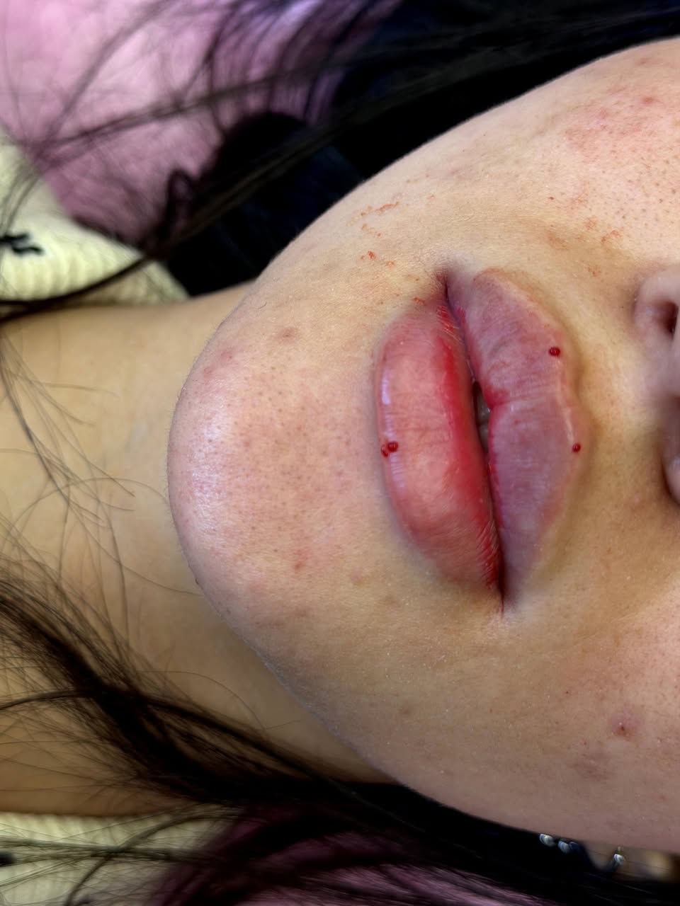 ‏✨شغلي بالتجميل مو بس مهنة✨…هو فن🥰
‏يبرز جمال كل وحدة بطريقة ناعمة ومميزة.😍
‏أهتم بأدق التفاصيل، لأن الجمال الحقيقي يكمن في البساطة والإتقان.
‏#عيادةالدكتورةنبأمكي 😍
‏لطب وتجميل وزراعة الأسنان🦷
‏والحقن 💉والتجميل اللاجراحي🩹💉
‏احجزي موعدك وخلي جمالك يحكي لكِ 🤍
‏
‏📍العنوان_الأعلام شارع البدالة_ مجمع القمة الطبي
‏☎️ ***********
‏
