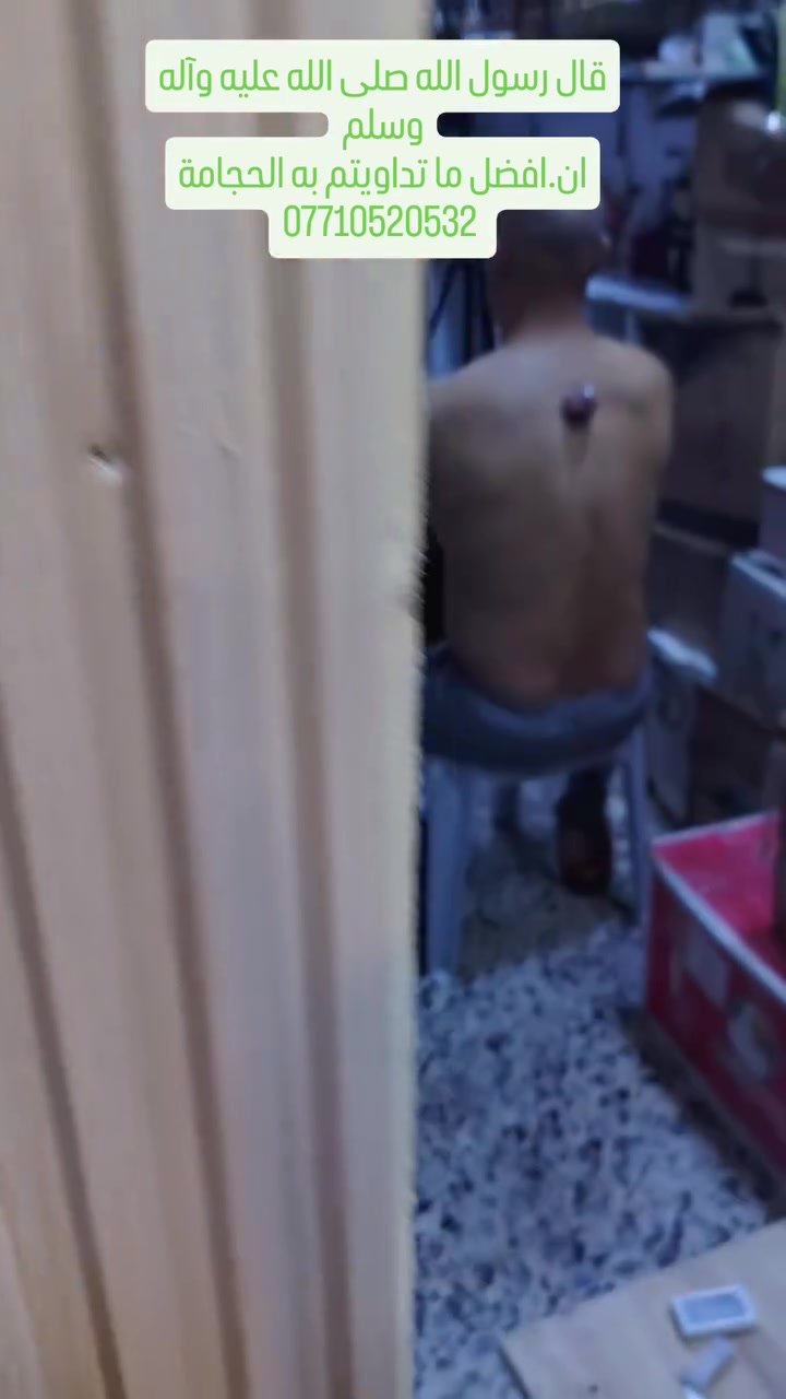 قال رسول الله صلى الله عليه وآله وسلم
ان.افضل ما تداويتم به الحجامة
انصح كل شخص عندة لزوجة بالدم او الام في الجسم الحجامة شي مهم يسوي وافضل مكان نقرة الظهر
الحجامة متوفرة عدنة مجانا للأجر والثواب الي يحب يشرفنا احنة بالخدمة عنواني سبع البور شارع السوداني عطاريةابوهاشم ***********
