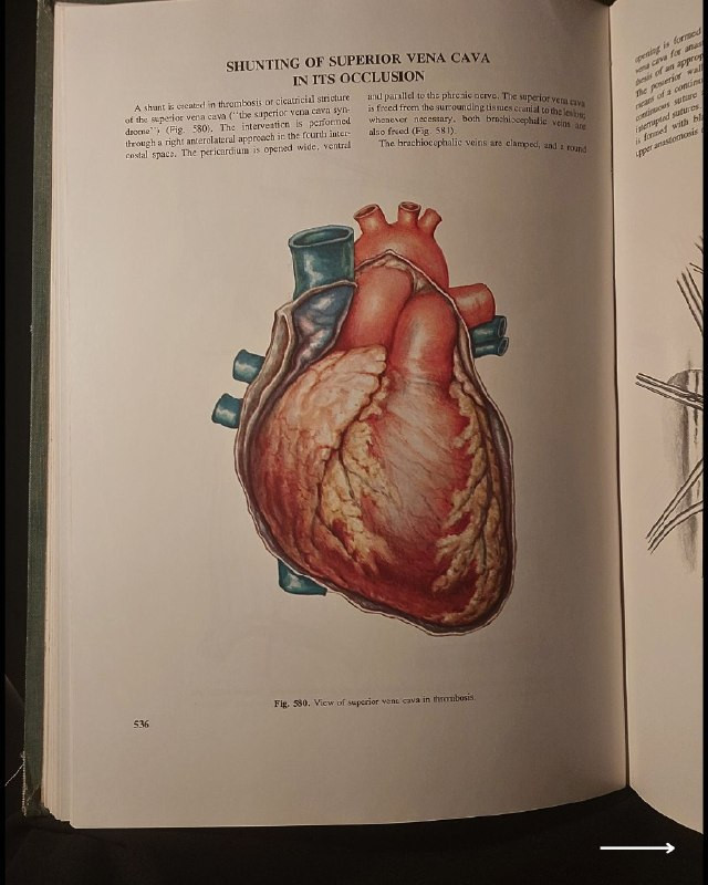 "أطلس جراحي طبي نادر وفخم من روائع الطب السوفيتي الأكاديمي! "
🚩
🫁
🩺
💚
📘
(Atlas of Thoracic Surgery - Volume Two)
المحرر: الأكاديمي بوريس ف. بيتروفسكي (Academician Boris V. Petrovsky).
⚜️
📚
🚩
☭
✨
عن هذه النسخة التراثية:
سنة الطبع: 1979م (طبعة أصلية قديمة ونادرة صادرة عن دور النشر العلمية السوفيتية المترجمة للإنجليزية).
الحالة: ممتازة
✅
⚜️
الموضوع:
أطلس جراحي موسوعي وفخم يتناول جراحة الصدر والأوعية الدموية الكبرى والقلب والرئتين بالتفصيل التشريحي والعملياتي الدقيق، يضم مساهمات كبار علماء الجراحة في الاتحاد السوفيتي السابق، يهم جداً أطباء جراحة الصدر والقلب، طلاب كليات الطب والصيدلة، وهواة اقتناء المراجع الطبية التراثية الأجنبية النادرة.
🔹
السعر: 35 د. ع.
📜
للحجز
🔻
:
البوت:
@PH_900bot
أو واتساب: ***********
