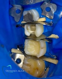 بسماية الشارع العام • حجز • واتساب