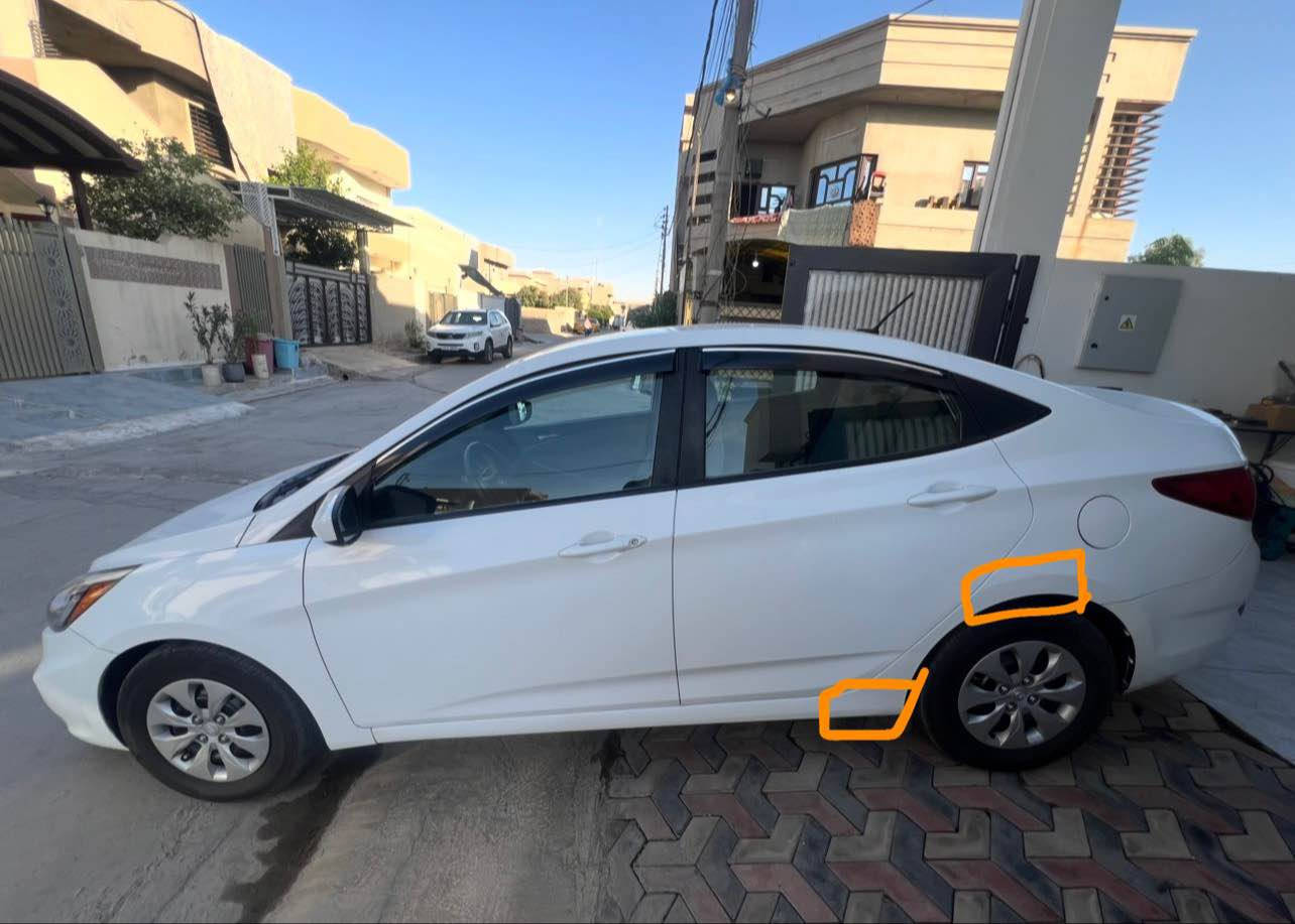 كسنت 2017 مكينه gdi بدون صرف و بدون بخار فقط تبديل كازكيت سياره ماشية 100 الف باتري جديد و 4 تايرات جديد سياره بدون نواقص وكلين بدون ضربه و بدون دواخل تعديل بارد pdr فقط هلاهين خلفي و شبر بل دوسة طرف سايق صبغ و موضوح بل صوره و تحويل ثاني يوم و بي بطاقة بانزين
للاستفسار *********** كركوك, العراق
