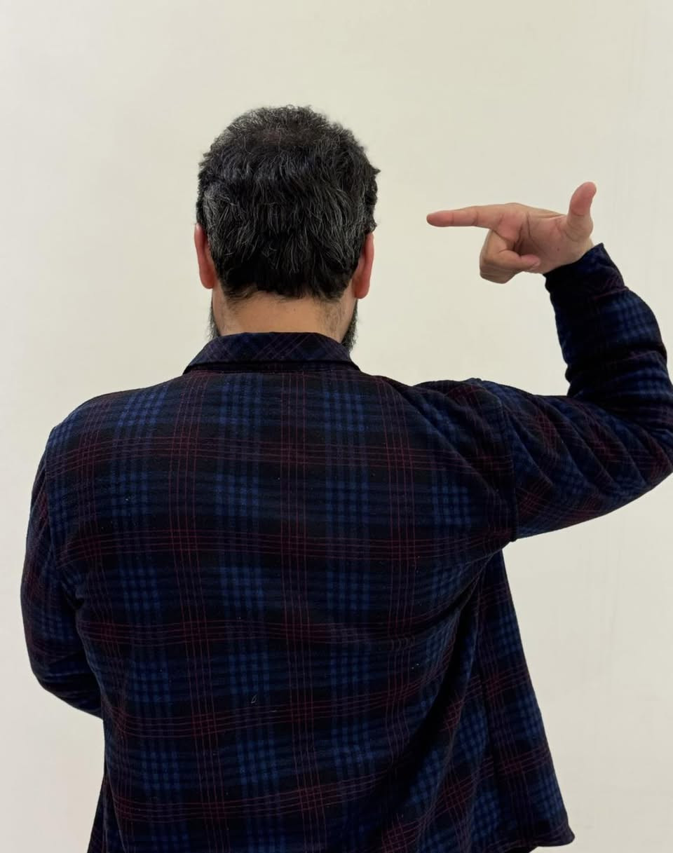 🔥🔥عرض العيد🔥🔥

نتيجه ٦ اشهر الزراعه🔥‎                         
🦋اكيد الكثافه يمنا وبس 🦋

🔥اخلص من مشاكل الشعر وانسى الصلع ويانا 🔥
✨زراعة الشعر بتقنية الـ 3D و6Dوبنفس اتجاه الشعر الطبيعي 
       🔥بتغطية كامله للصلع بجلسة واحده فقط 🙂💯
🔥ورسمه تكون حسب اختيارك وطلبك🧚‍♀️
‌‎ 🔥قطف بإعداد مفتوحه من البصيلات (دون تشوه و اثار بالمنطقه المانحه)
 🔥فتح قنوات بتقنية السفير استخذام فعلي وليس اعلان
 🔥تتم العمليه ع ايادي اطباء مختصين🦋

☄️فقط في مركز ارمادا التخصصي للزراعة الشعر ☄️

‏🌪{𝑉𝐼𝑃 𝑆𝑃𝐸𝐶𝐼𝐴𝐿}🌪العرض الذهبي 750 الف 🔥  

✨10جلسات بلازما ايطالي المنشأ مجاناً💥
✨10 ميزو ثيرابي اسباني المنشأ مجاناً 💥
✨جلستين نضاره للبشره مجاناً💥
✨حقيبه علاجيه متكامله💥
✨وجبة طعام للمريض 💥
✨يشمل العرض كل التحاليل والفحوصات💥
✨تخدير موضعي بجهاز الكومفورت دون الم 
✨العناية بشعر وغسلة لمدة 12 يوم💥
✨شهادة ضمان مدى الحياة💥
✨العناية بشعر المزروع لمدة سنه💥

️ ️️~يتوفر نظام الاقساط 🕊️
      ~القسط الشهري بدون مقدمه 🌪️
~لحاملي بطاقة الماستر كارد الرافدين حصرآ🪐

🦋العنوان :- المنصور ١٤ رمضان  
🦋للحجز و الاستفسار :-الاتصال ع الارقام التاليه

***********
