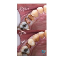 تراكيب أسنان • نظام اقساط • المحمودية