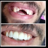 تنظيف اسنان مجاني • تركيب اسنان بالتقسيط • عيادات الايمان