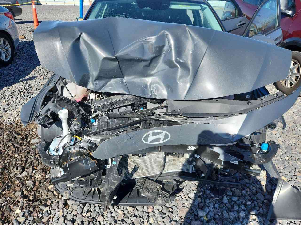 السلام عليكم النترا هايبرد 2024مواصفات سيل رادارات بصمة لد أوتو هولد شاشة دجتل توقف ذاتي ترحيب وبعد هواي مواصفات  على حادثها واصل الحرة الاردن السعر 105 بيها مجال بسيط 
للاستفسار ***********
