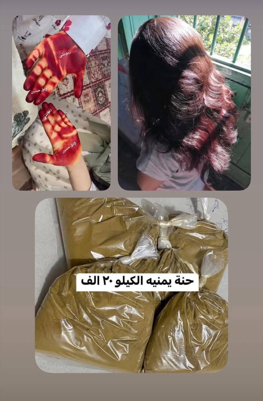 للحجز السريع على الرقم *********** يوجد واتساب

#حنه_يمنيه_جبليه سعر الكيلو ٢٠ الف 

#حناء_مصريه_معالجه سعر الكيلو ١٧ الف 

#حنة_الفاو_الاصليه سعر الكيلو ١٥ الف 

👇👇👇

• تقوي جذور الشعر وتقلل التساقط

• تكثف الشعر وتزيد سماكته

• تعطي لمعة ونعومة طبيعية

• تهدّي فروة الرأس وتخفف القشرة

• تغطي الشيب بلون طبيعي دافي

• مناسبة للشعر الخفيف والضعيف
