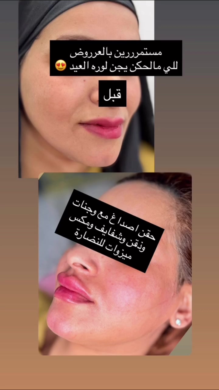 بنات جمال الشغل يمههه يجنن والنبي استغلن العروضlDuaa Al Shammariy


**إذا كنت صاحب هذا الإعلان وتريد حذفه لأي سبب، رجاءا أرسل رسالة إلى الدعم الفني**