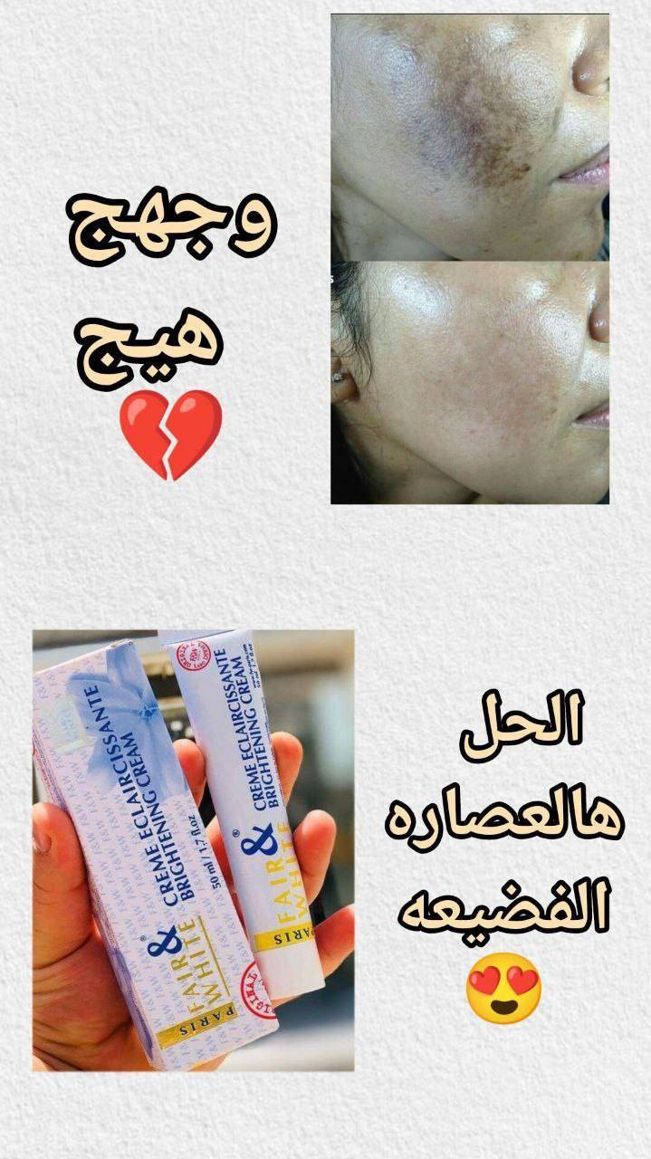 للاستفسار مراسلة الصفحة


**إذا كنت صاحب هذا الإعلان وتريد حذفه لأي سبب، رجاءا أرسل رسالة إلى الدعم الفني**