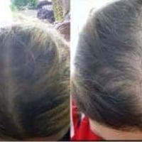 زيت شعر • يمنع التساقط • عشبي