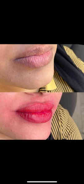 ارقى العروض من مركز لمسات  🫰❤️
عرض لمده اسبووووووعً🌺

هذا البيج مركز لمسات 

عرض التغيير الشامل ب٢٠٠ الفلر كوري  مع ابرة نضاره هديه♥️🥰

ب٢٥٠ مع البوتوكس الف بالفلر الفرنسي مع البوتوكس عرض ميتعوض فقط لحد  راس السنه♥️

فلر كوري السيسي ب٢٥ الف  للوجنات للشفه ب٣٠ 🌺

فلر امريكي ب٤٠ الف السيسي للوجنات للشفه ب٥٠  الف السيسي 🌺

فلر فرنسي ب٥٠ الف السيسي 
للوجنات و٦٠ الف للشفه 🥰😍
تغيير شامل يشمل البوتوكس بالفلر الكوري٢٠٠ الف يشمل بوتوكس وبدون بوتوكس ب١٥٠ الف مع جلسه نضاره وتنظيف وره اسبوع مجاني ♥️💐😍
عروض البوتوكس 
وجه كامل ٥٥ ♥️🥰

عين وجيبن ب٤٠ الف كل ثنين ب٧٥ عيون وجبين وجه كامل ١٠٠ للصديقات سوا ♥️

عرووض اليزر فل بدي ب٧٥ الف مع الظهر والبطن 💖
بكيني واندرام ثنينهن ب٢٥ 🌺

ساق كامله ب١٥ ايد كامله ب١٥ 😊
وجه ب١٠ رقبه ب١٠ 👌
مسح الاوشام  والتاتو الجلسه ب١٠ 🌺

ليزر كاربوني الجلسه ب١٠ 🌺

عروض البلازمه المفعله بالعمبر ب٢٥ الف الجلسه 💖💐
فقط بلازمه مفعله ب١٠ الجلسه 😊♥️

عرووض الميزوات جميع انواع الميزوات وابر النضاره الجلسه ب٢٥ 😍🌺

جميع العرووض تشمل تنظيف بشره ♥️🌺♥️💖مجاني مع كل جلسه وتدددلون علينه 🥰

للاستفسار الاتصال واتساب ***********
