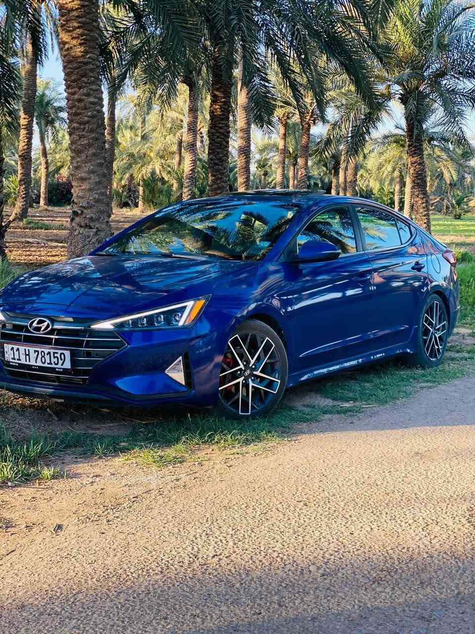 النترا 2020 فول مواصفات لمتدد مكينه 1600 اتوين تيربو كير اتلث تحكمات سياره ابلك مال شركه برغي ما مفتوح بيها بصمات 2 ماشيه 49 بسمي تحويل ثاني يوم
للاسفسار ***********
النترا 2020 فول مواصفات لمتدد مكينه 1600 اتوين تيربو كير اتلث تحكمات سياره ابلك مال شركه برغي ما مفتوح بيها بصمات 2 ماشيه 49 بسمي تحويل ثاني يوم السعر 125
