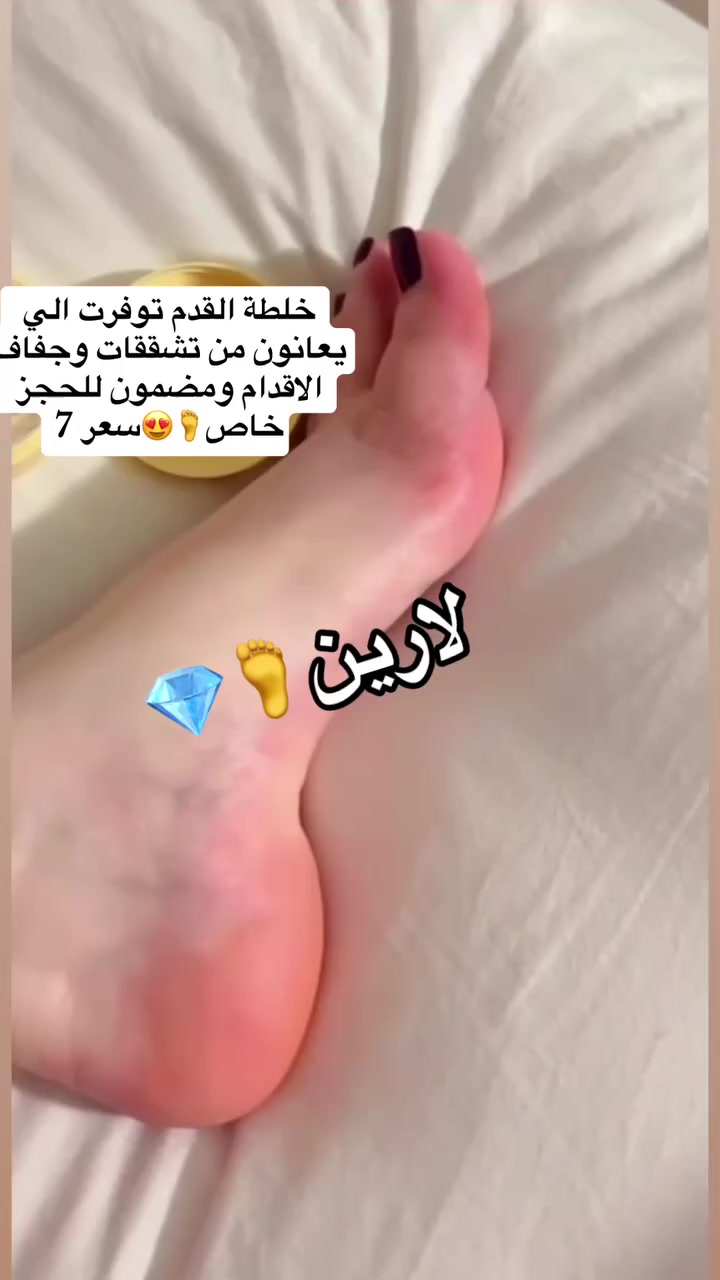 للحجز خاص🚚🛍️💎


**إذا كنت صاحب هذا الإعلان وتريد حذفه لأي سبب، رجاءا أرسل رسالة إلى الدعم الفني**