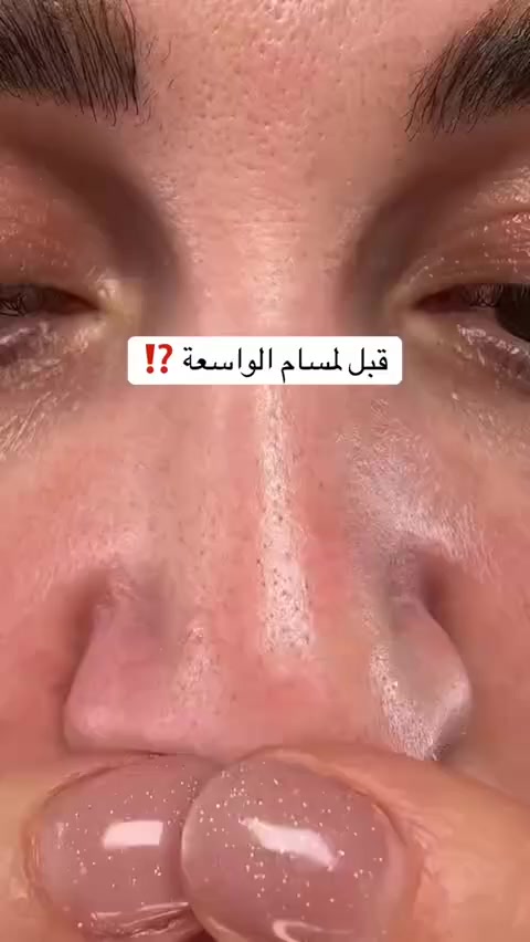 🧡دكتور ميلاكسين🧡


**إذا كنت صاحب هذا الإعلان وتريد حذفه لأي سبب، رجاءا أرسل رسالة إلى الدعم الفني**