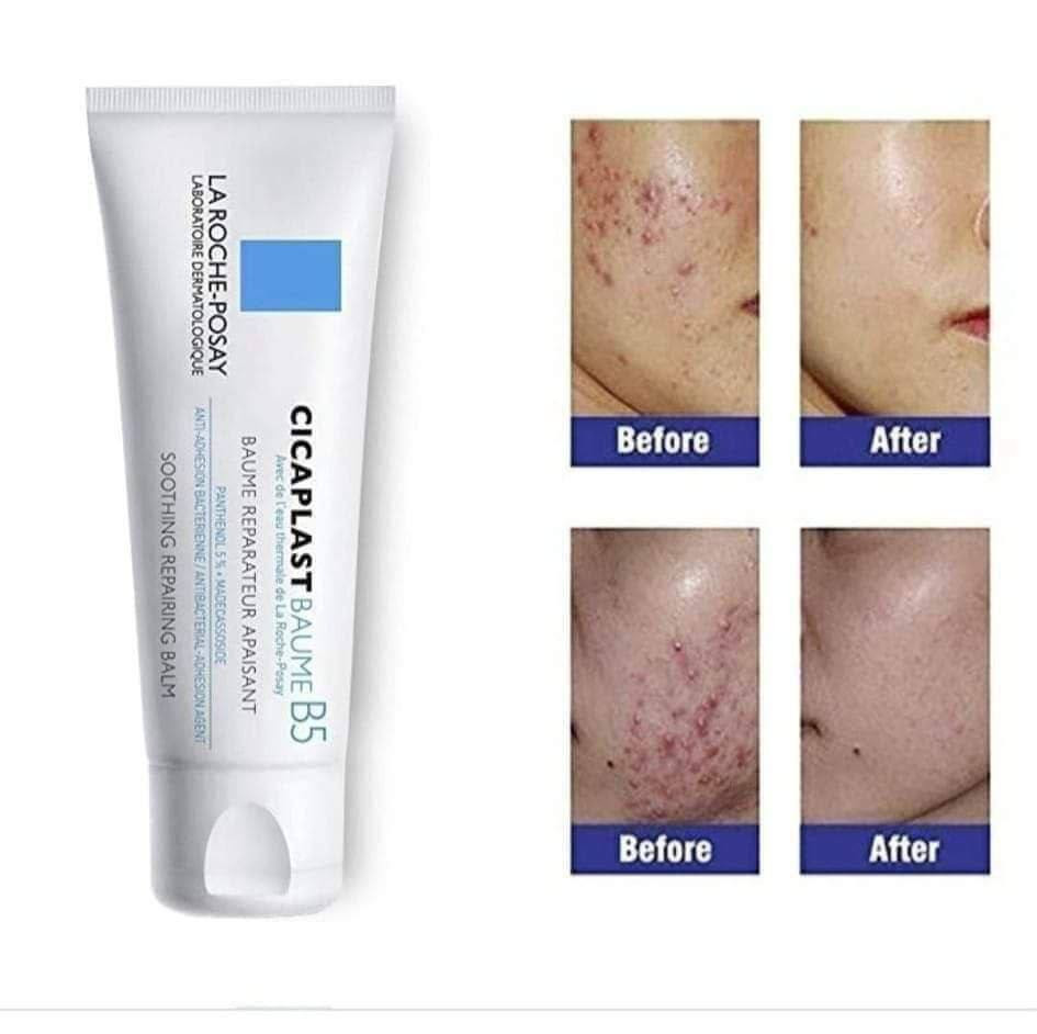 ‏💙+CICAPLAST_BAUME_B5 
من شركة لاروش بوزية 
وفرنا لكم كريم سيكا بلاست الاصلي متعدد الاستعمالات 

💯كريم سيكا بلاست من لاروش بوزيه الفرنسيه 🇫🇷 
💯 لإصلاح وتهدئة وحماية البشرة من (التهيج ،التشقق ، 
البقع الخشنة ). 
💯لترميم البشرة وحمايتها من الجفاف ما بعد الليزر 
وبعد التقشير. بعد الديرما بن او ديرما رولر 
💯يستخدم لتهدئة تهيجات البشرة بعد جلسات (الديرمابن والديرما رولر و بعد الهيدرافيشيال) . 
💯 تقدري تستخدميها ك ترطيب للبشره الجافه اللي ماينفعش معاها الترطيب العادي. 
💯يمكن تطبيقها على الجسم والوجه 😘 💯مناسبة جداً للبشرة الحساسة 
💯 مفيد جدا لجلد الوزة ولازالة كافة انواع الندب ع الجلد واثار الجروح 
والحروق وحفر الوجه واثار حب الشباب المستعصية 
واثار العمليات الجراحية  والتشققات الجلدية 
يرمم البشرة بشكل سريع  خلال فترة بسيطة 
المنشأ فرنسي 🇫🇷 @إشارة


**إذا كنت صاحب هذا الإعلان وتريد حذفه لأي سبب، رجاءا أرسل رسالة إلى الدعم الفني**