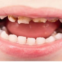 عالج اسنانك واسنان اطفالك مجانا وبإشراف افضل الاخصائيين علاج اسنان الا...