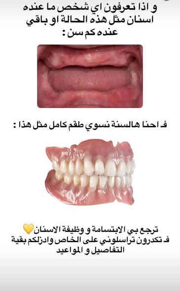 العلاج #مجاني لفترة محدودة
تعلن عيادات طب الاسنان في جامعة الكوفة عن استقبال المراجعين الذين يعانون من :
1- تكلسات وتصبغات الأسنان (تنظيف الأسنان) 
2-قلع الاسنان التالفة وبقايا الجذور
3- ازالة جميع التسوسات وعمل حشوات تجميلة
4- تعويض الأسنان المفقودة بطقم جزئي متحرك
للأستفسار اكثر مراسلة صفحتنا 
او عن طريق الواتساب ***********

#صحة #اسنان #مجاني #اهتمام #رخيص
