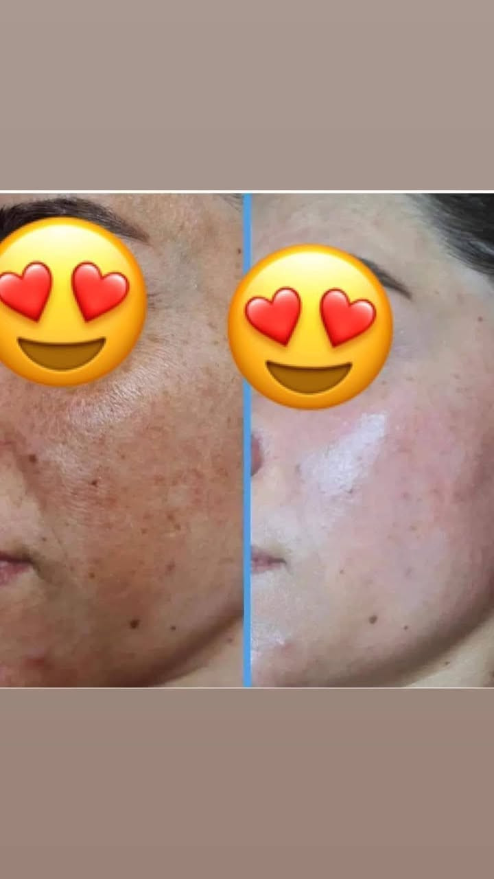 تعالو غيري نفسيتج وبشرتج للعيد بهل منتج الخيالي الله شاهد وحق هذا الشهر مضمون وشغال  تبيض الوجه والرقبه
(ليش تخسرون فلوسكم ابلاش )جبتلكم خلطه_ام_حسن 🌬️
مميزات وفوائد الخلطة
1.تبيض الوجه وازالة التصبغات
2.اخفاء الهالات السوداء حول العينين
3 .الرؤوس السوداء و الكلف والنمش
4. شد البشره و القضاء على التجاعيد
5 تعالج حب الشباب 
((للرجال والنساء))

يوجد توصيل لكل المحافضات


**إذا كنت صاحب هذا الإعلان وتريد حذفه لأي سبب، رجاءا أرسل رسالة إلى الدعم الفني**