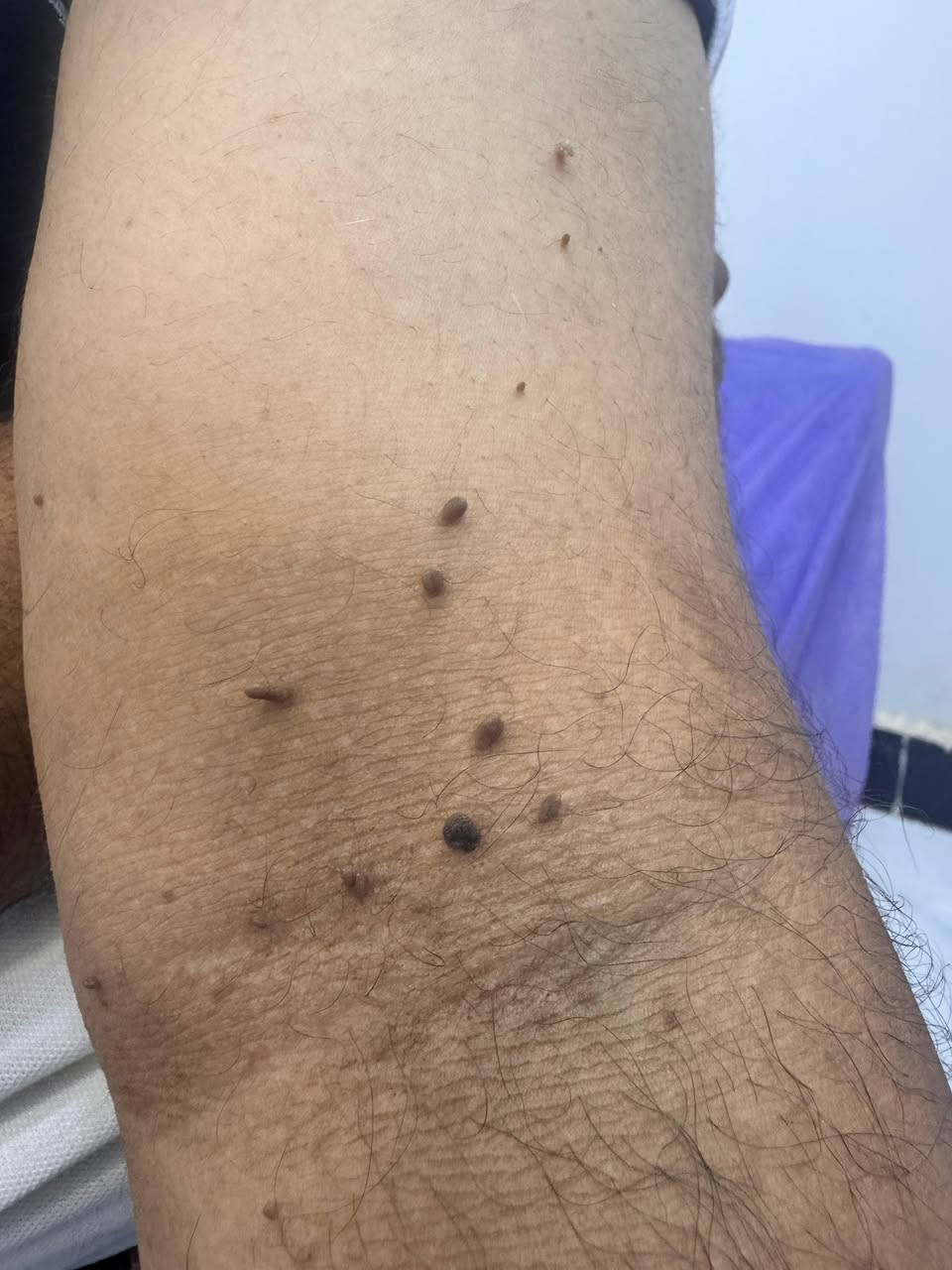 تخلص من الزوائد اللحمية بسهوله 
بأحدث الاجهزه 
العنوان طريق ناحية صباغية مقابل جامع سويف
للاستفسار 
***********
