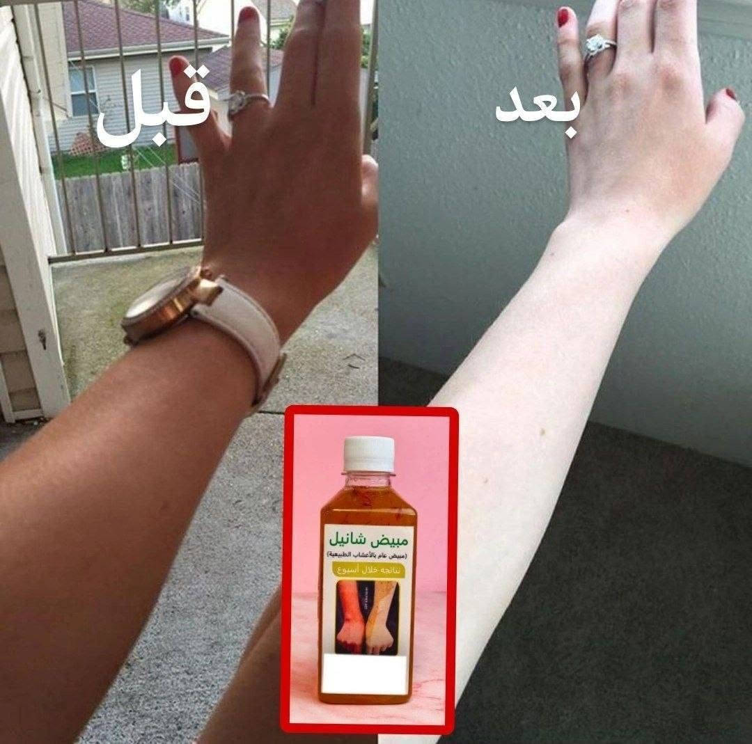 شراب شانيل لتبيض الوجه وجسم اعشاب%100شراب شانيل لتفتيح وتوحيد لون البشرة ..الاصلي ( شراب تبييض الوجه والجسم نضارة وتفتيح وشد للبشرة

#للحجز_والاستفسار_دايركت


**إذا كنت صاحب هذا الإعلان وتريد حذفه لأي سبب، رجاءا أرسل رسالة إلى الدعم الفني**