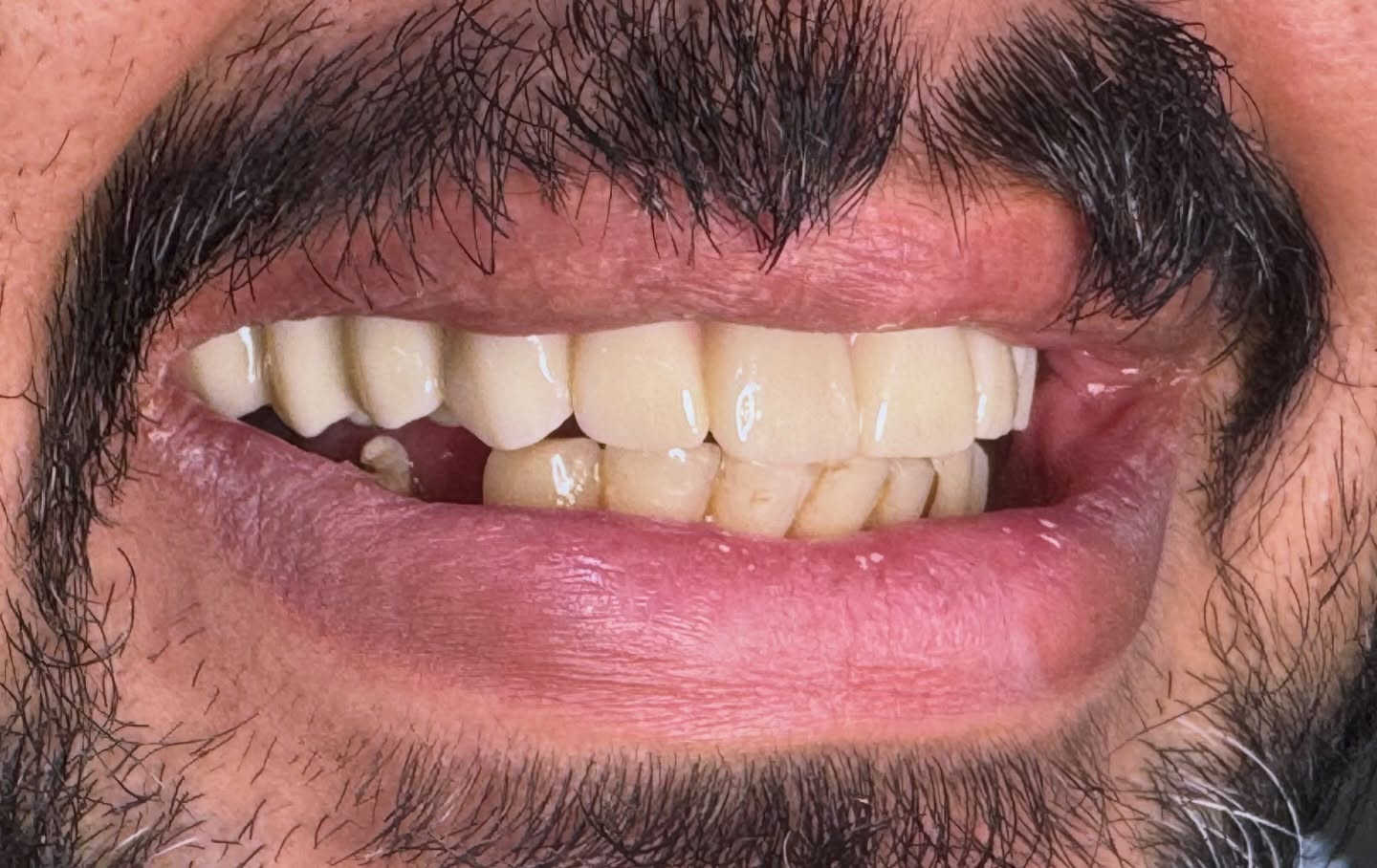 عيادة دكتور احمد المندلاوي 
عنوان العيادة / السوق الأول _ مجاور صيدلية سما العافية _ فوق ازياء بولو 
رقم العيادة / ***********
جلسات سريعة ونتيجة مضمونة
